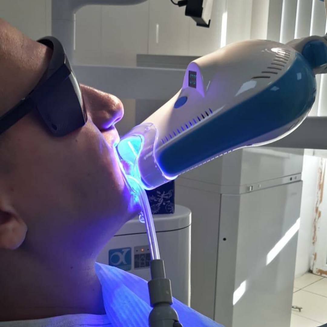 Здоровые зубы и дёсны: красивая улыбка для каждого - 2x2.su картинка 4