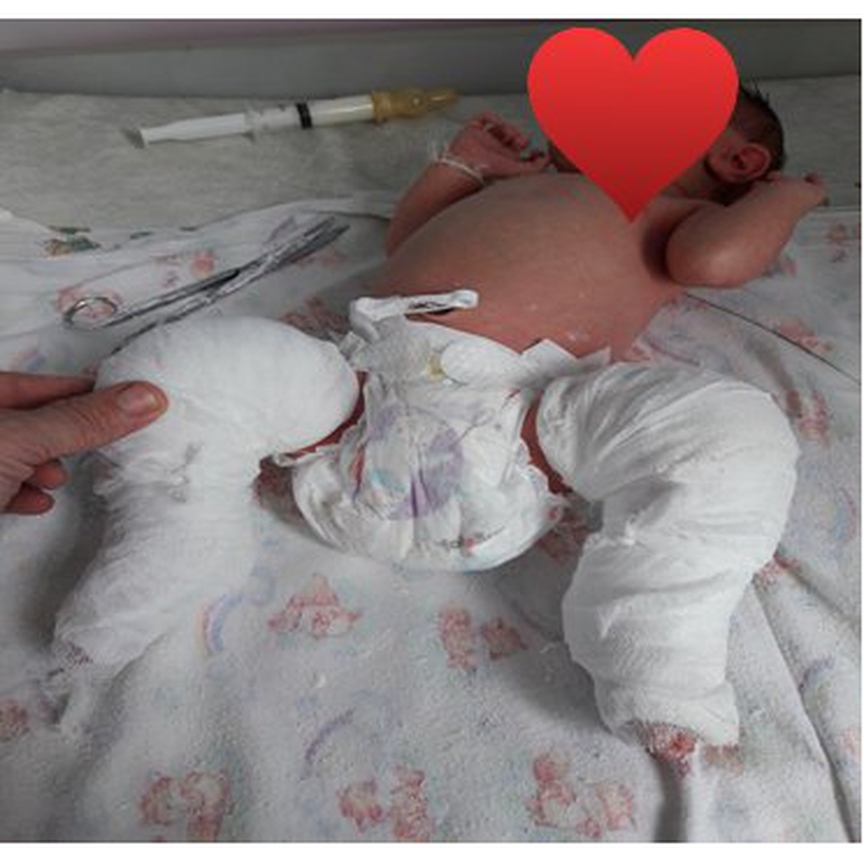 В Приамурье врачи вылечили младенца с редкой врождённой патологией - 2x2.su картинка 3