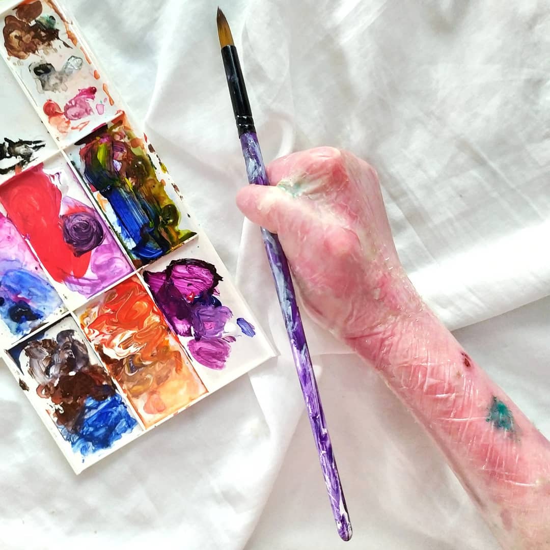 Прикосновение – боль: девочка-бабочка из Свободного рисует картины