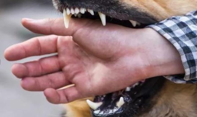 В Приамурье администрация выплатит деньги семье покусанного собакой ребёнка