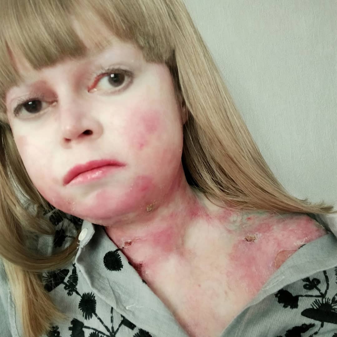 Прикосновение – боль: девочка-бабочка из Свободного рисует картины - 2x2.su картинка 2