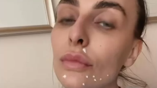 Екатерина Варнава опубликовала фото без макияжа, пожаловавшись на проблемы - 2x2.su картинка 2