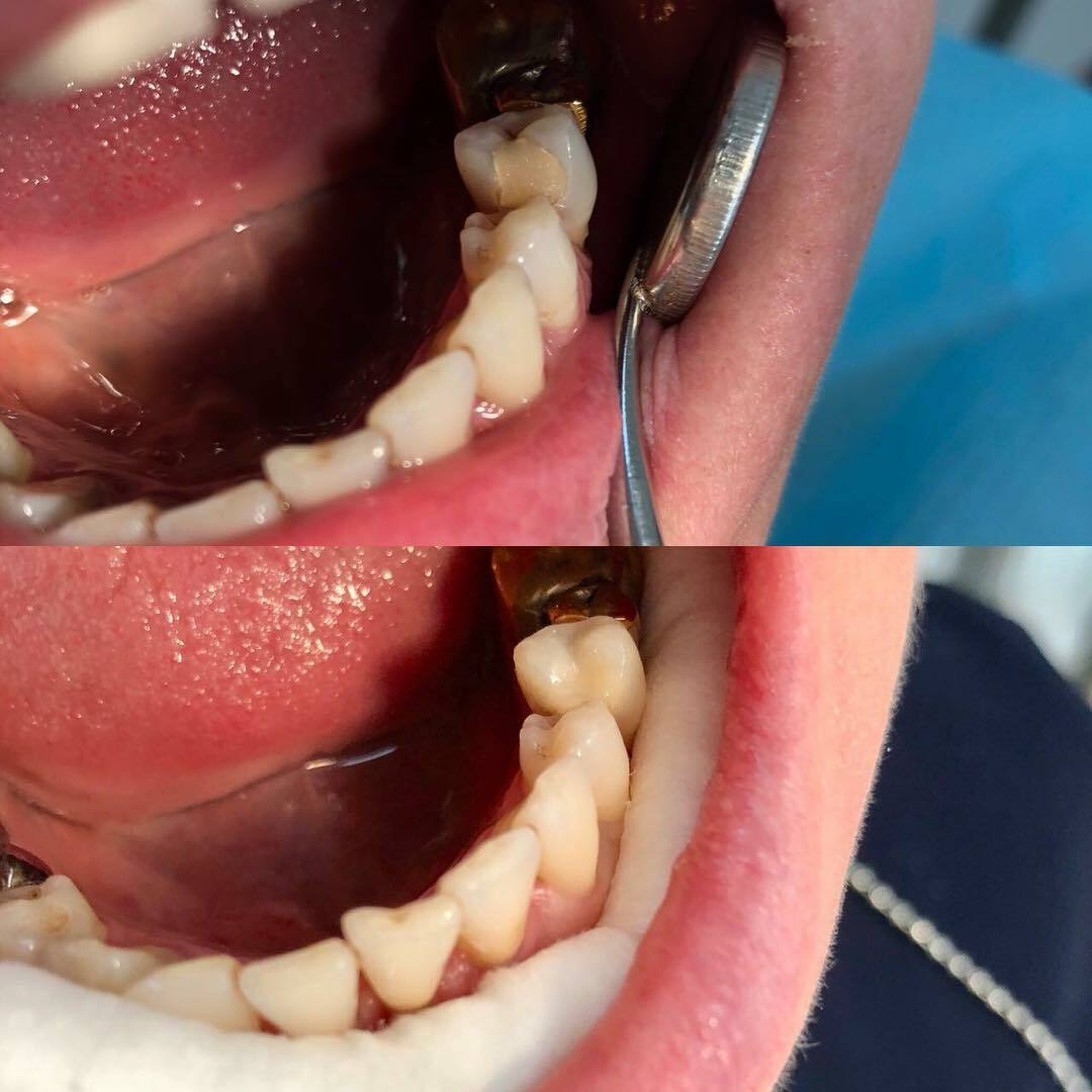 Здоровые зубы и дёсны: красивая улыбка для каждого - 2x2.su картинка 5