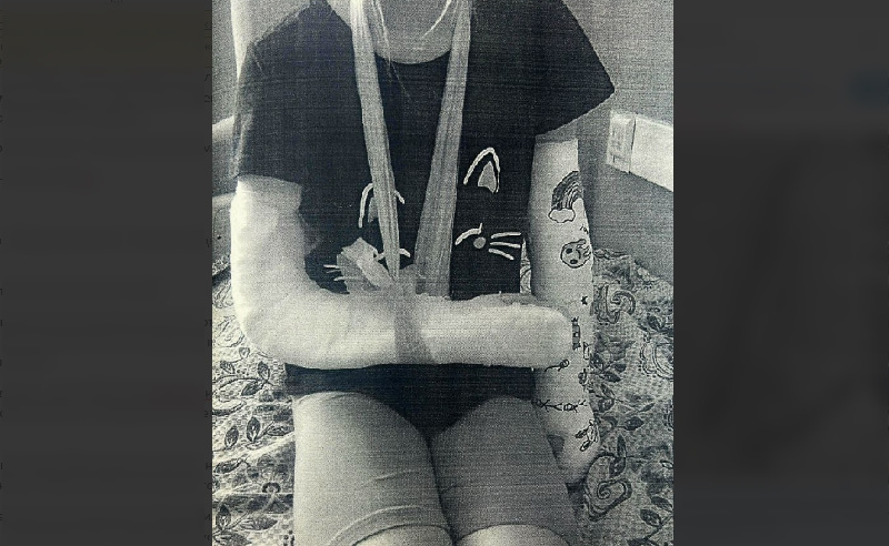 11-летняя благовещенка, сломавшая кости рук после падения с самоката, получит 400 тыс. рублей от ГСТК - 2x2.su